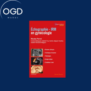 ECHOGRAPHIE – IRM EN GYNECOLOGIE – ECHOGRAPHIE- IRM