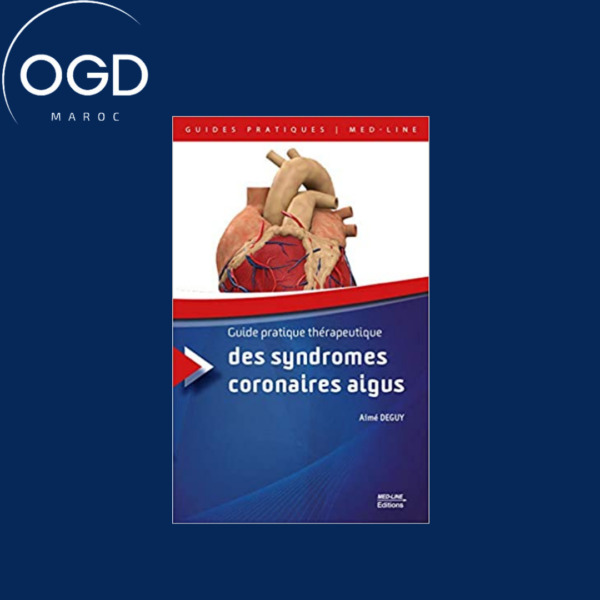 Guide pratique therapeutique des syndromes coronaires aigus