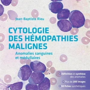 Cytologie des hémopathies malignes. Anomalies sanguines et médullaires